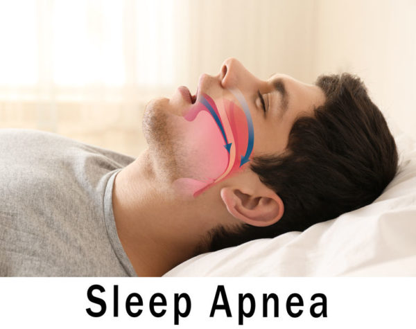 can an old mattress worsen sleep apnea